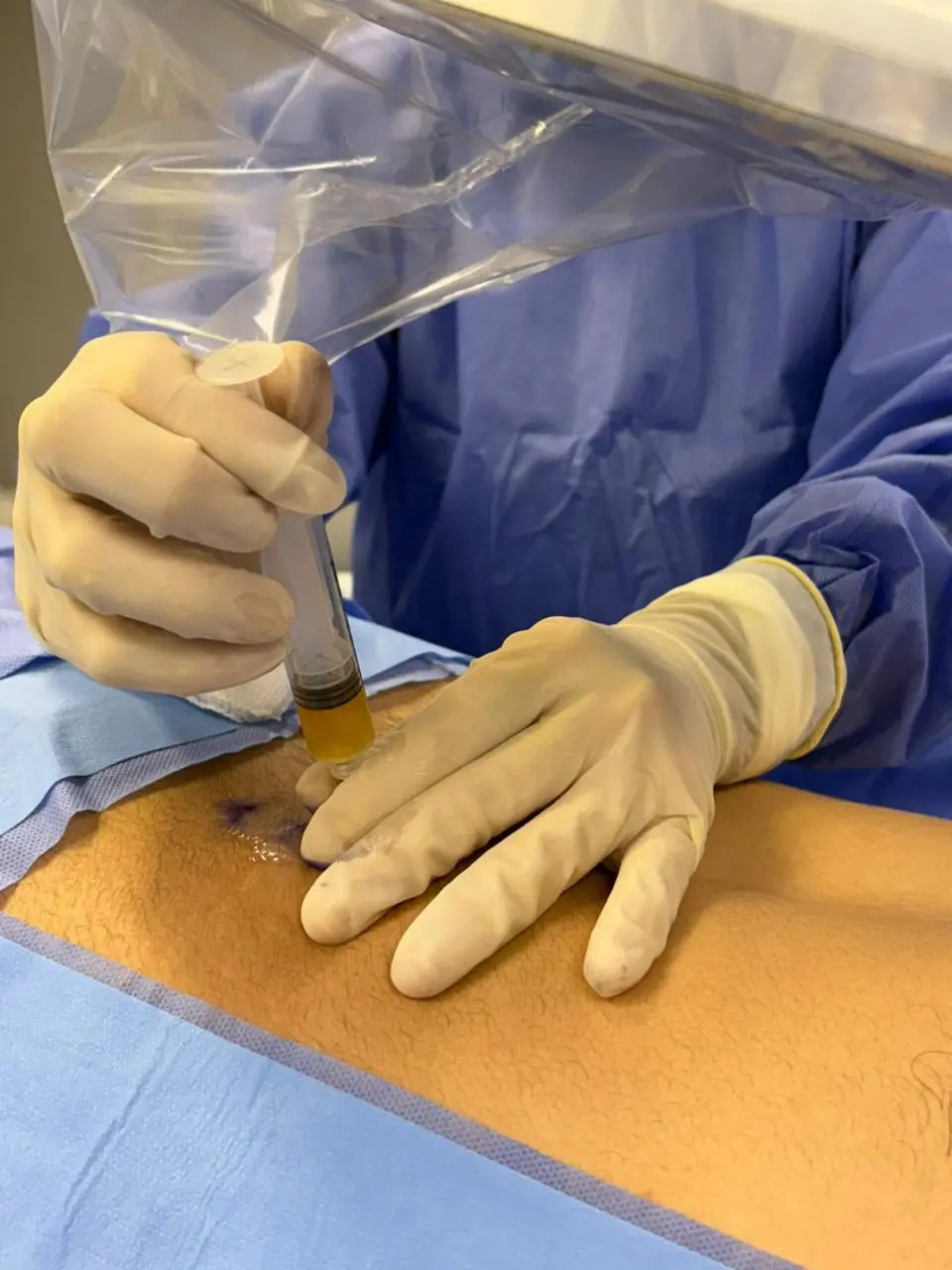 Ortobiológicos: a medicina regenerativa no tratamento da dor
